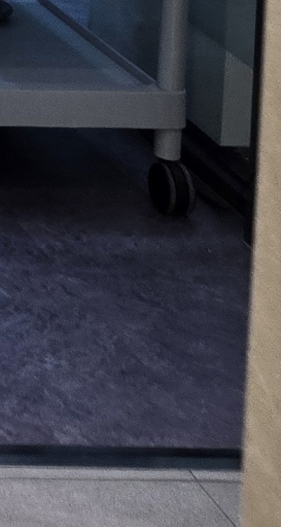 앞니 올세라믹 이건 알고 시작하세요 관련 이미지 48