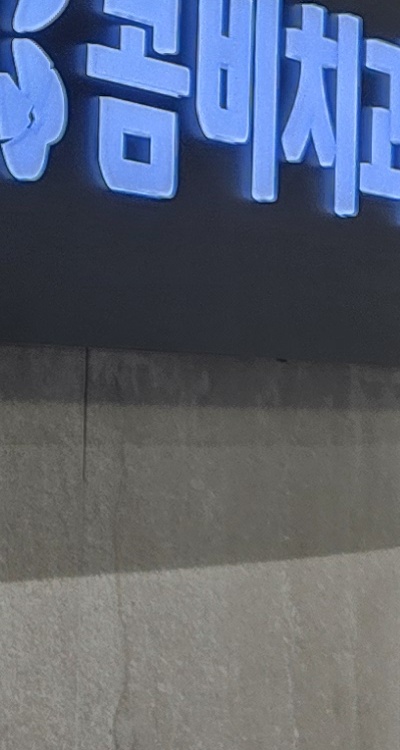 앞니 신경치료 크라운 까지 해야할 상황이라면 관련 이미지 37