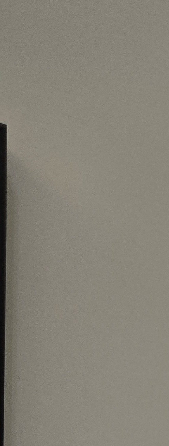 비발치 돌출입 교정 어떨때 적절할까 관련 이미지 23