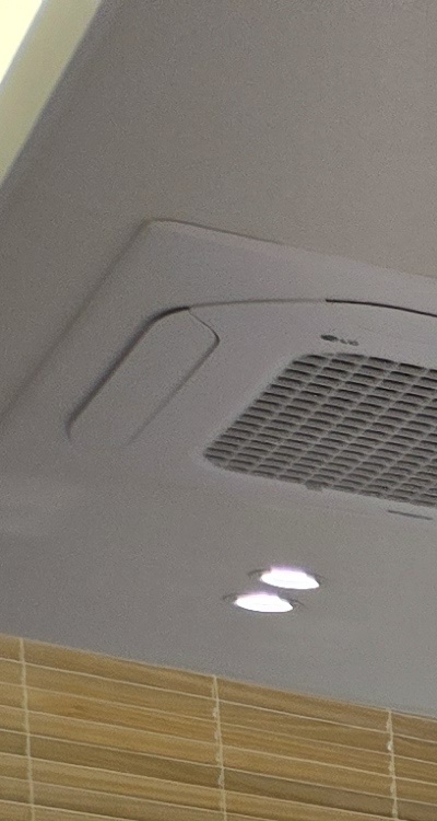 임플란트 뼈이식 안하면 어떤 문제가 있는거죠 관련 이미지 14