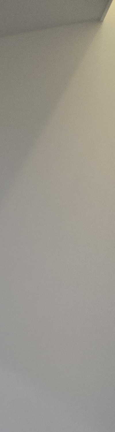 어금니 없으면 얼굴 발음에 어느정도나 안좋을까 관련 이미지 24