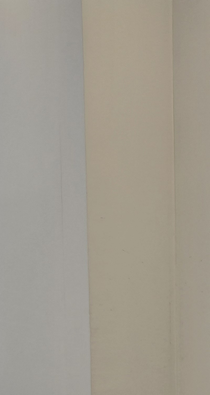 어금니 임플란트 과정 제대로 이해하려면 관련 이미지 14