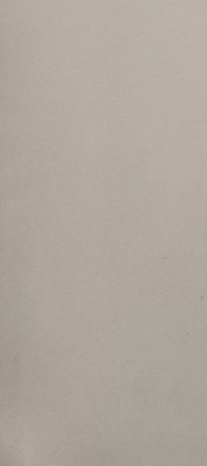 어금니 임플란트 과정 기간 어느정도 예상되나요 관련 이미지 18