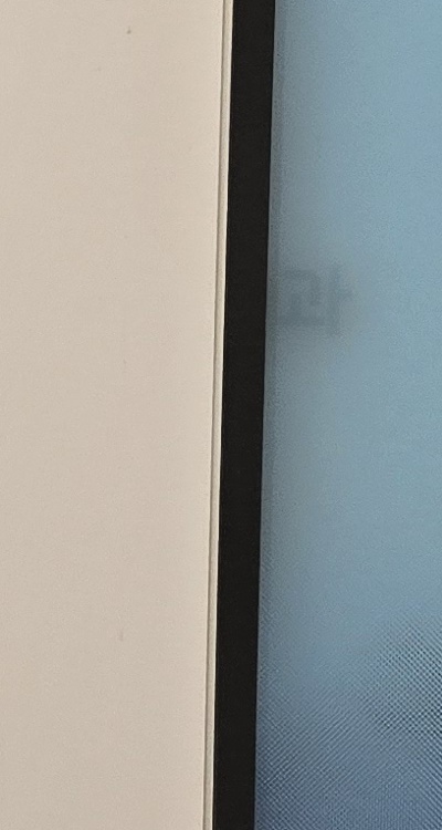 앞니 올세라믹 이건 알고 시작하세요 관련 이미지 36