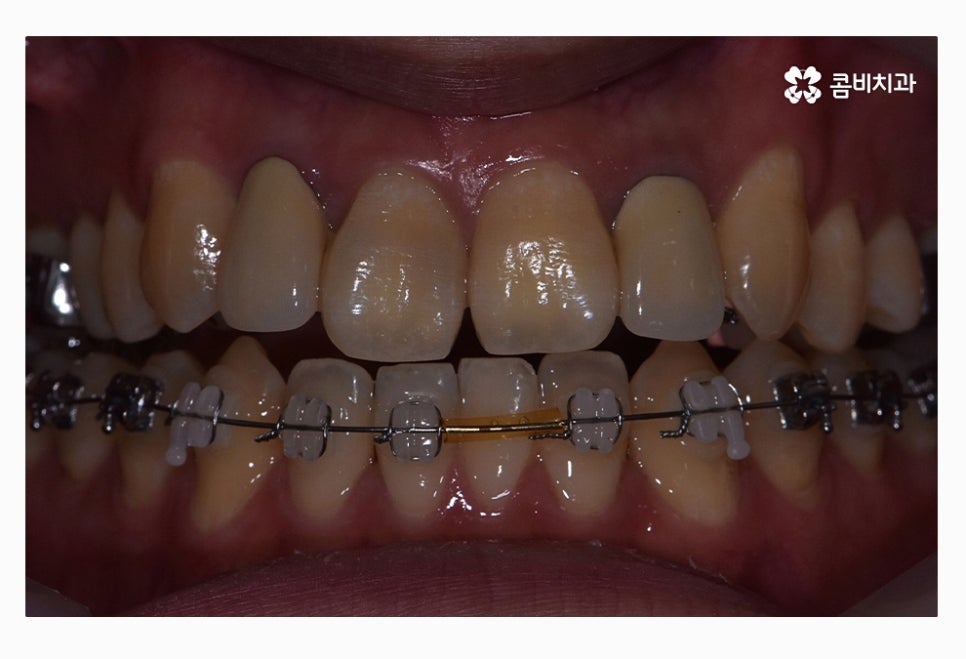 콤비교정 올바르게 판단하려면 관련 이미지 6