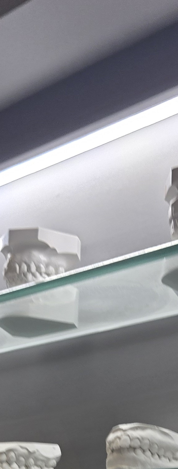 치과 치아미백 효과 어떤식으로 나타날까 관련 이미지 33