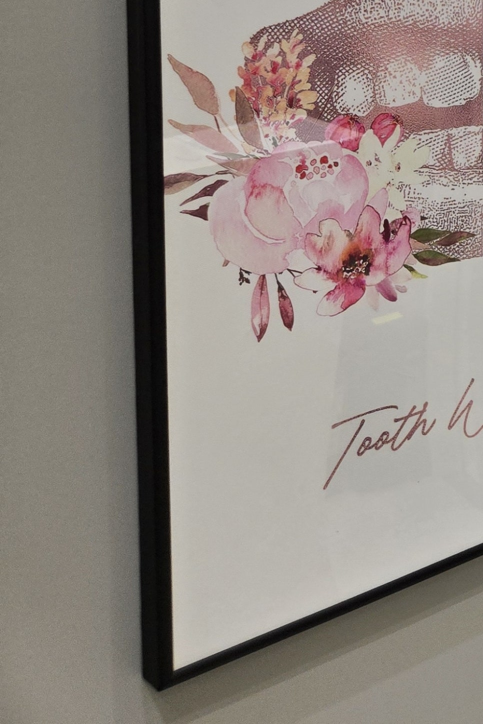 부분매복 사랑니 발치 신중하게 대비하려면 관련 이미지 27