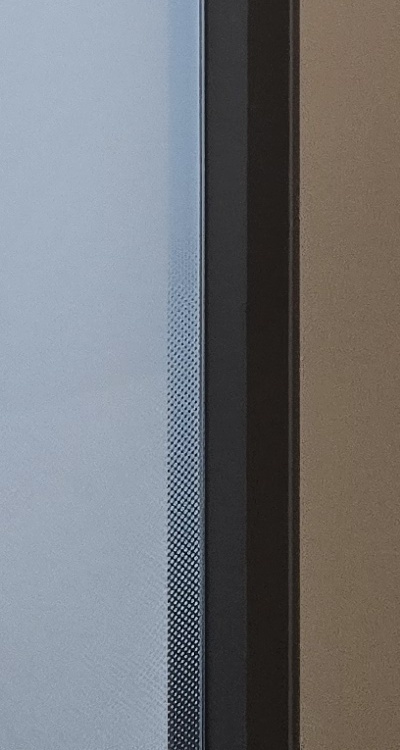 사랑니 발치 후 충치 치료 둘다 준비하려면 관련 이미지 45