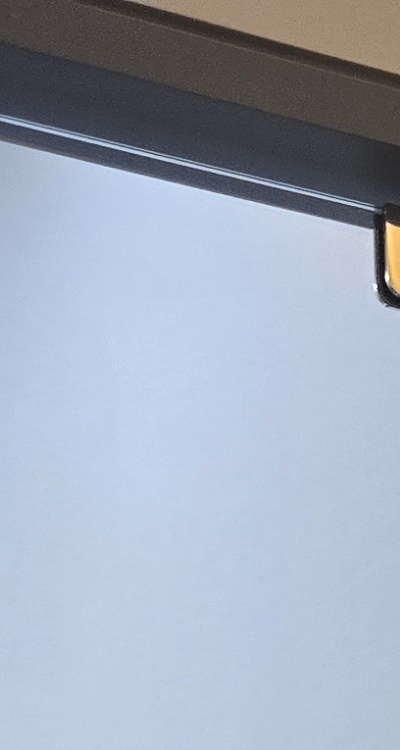 사랑니 발치 후 충치 치료 둘다 준비하려면 관련 이미지 14