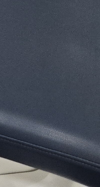 치아 사이 벌어짐 심해지는 이유부터 알아보면 관련 이미지 45