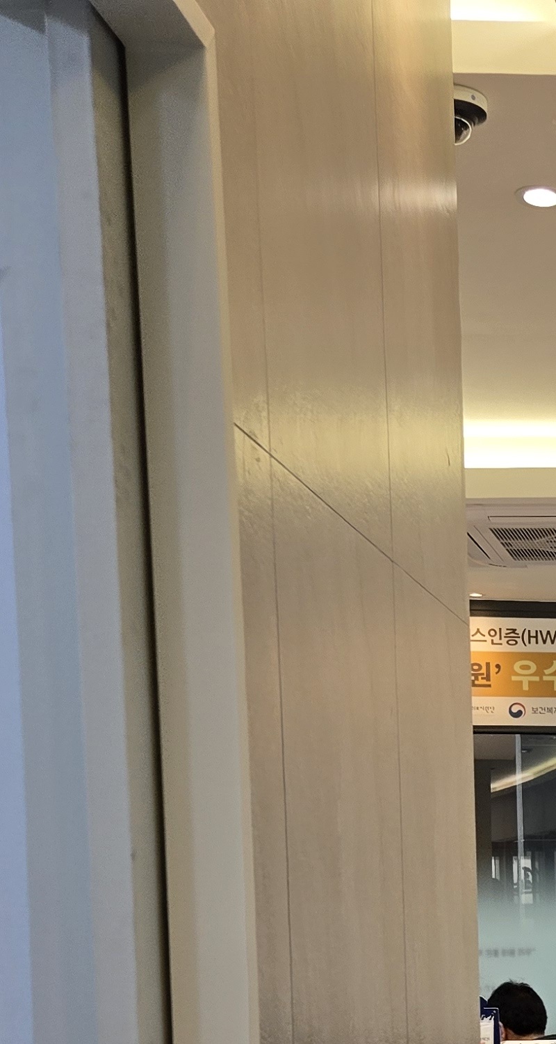 어금니 충치 단계 미리 알아차리려면 관련 이미지 26