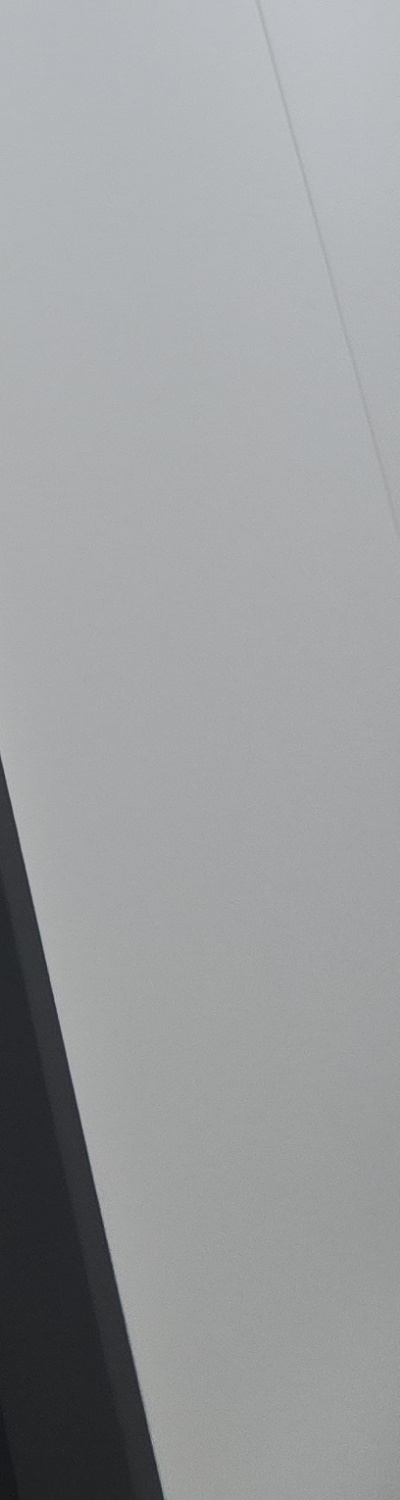 앞니 크라운 교체 깔끔하게 정리하려면 관련 이미지 28