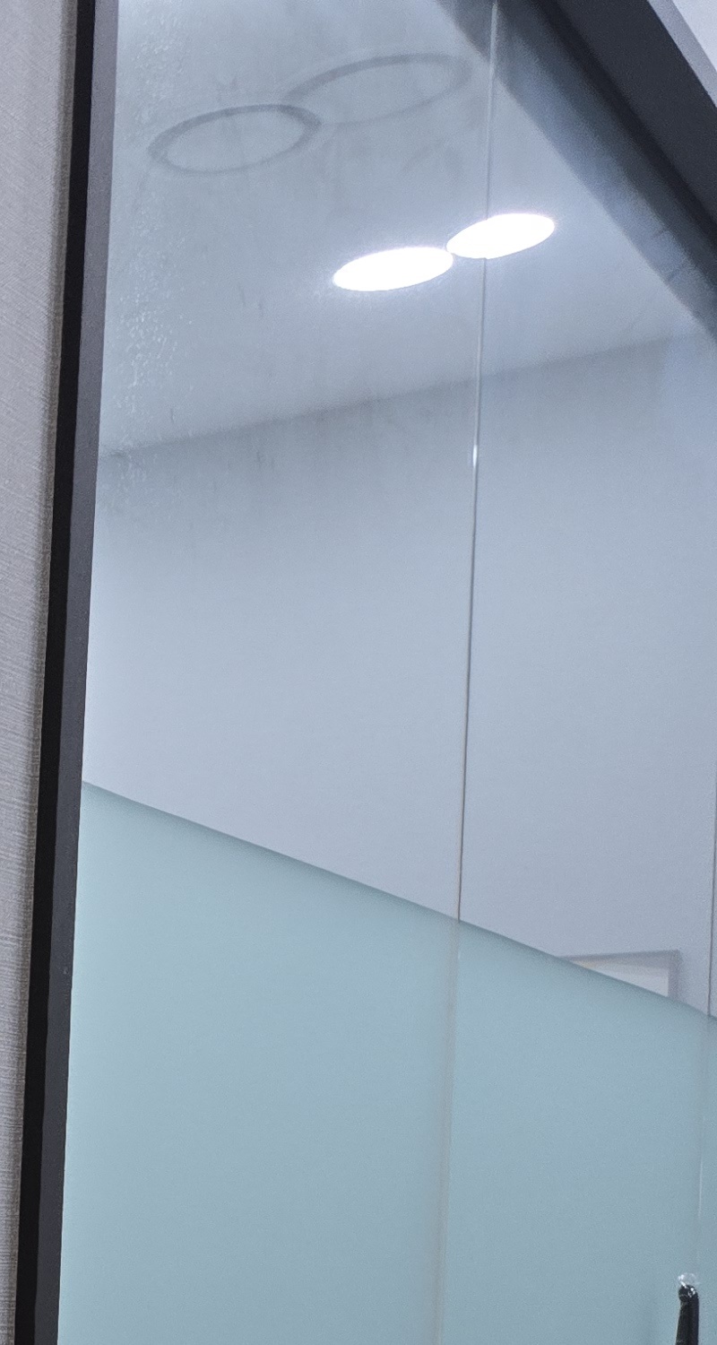 치아 시림 통증 갈수록 심해지다면 관련 이미지 19