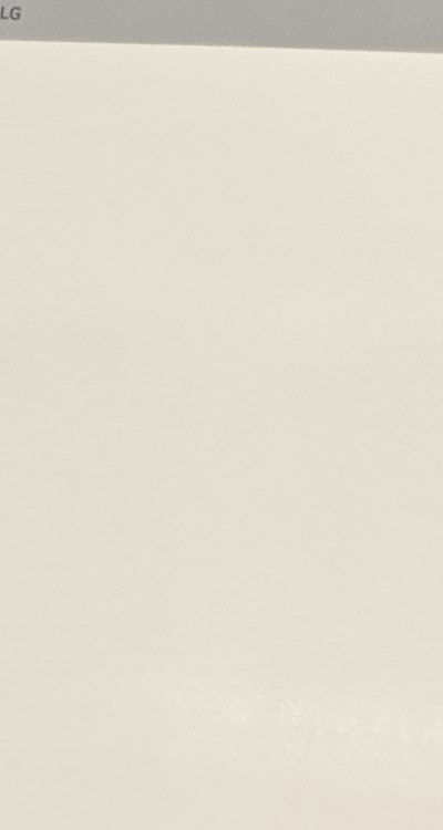 어금니 임플란트 안하면 후회하게 되는걸까 관련 이미지 20