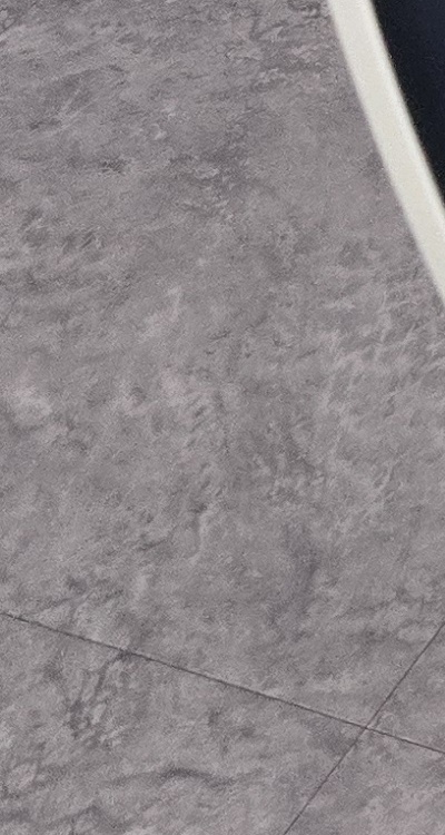 치아 사이 벌어짐 심해지는 이유부터 알아보면 관련 이미지 30