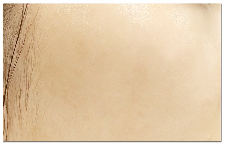 얼굴피지제거 제격이야! 관련 이미지 8