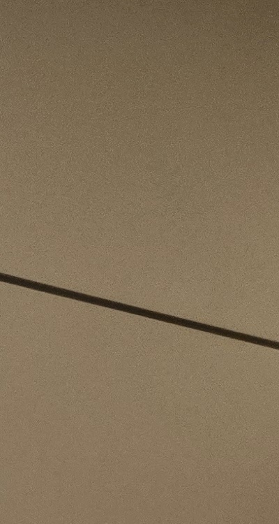 사랑니 발치 후 충치 치료 둘다 준비하려면 관련 이미지 18