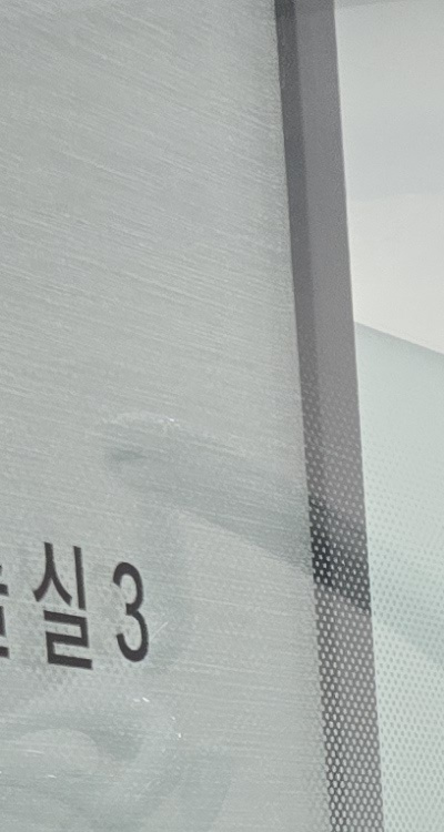 충치 검은점 나타났다면 이렇게 대처해요 관련 이미지 14