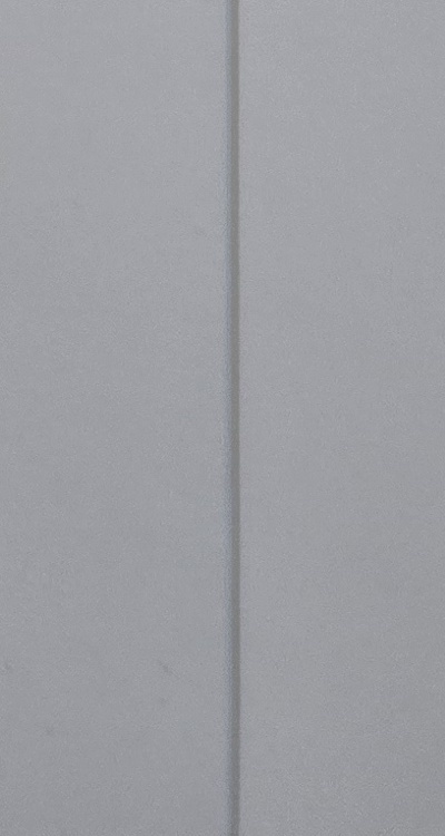 앞니 부분 교정 간단하니까 좋은건가요 관련 이미지 50