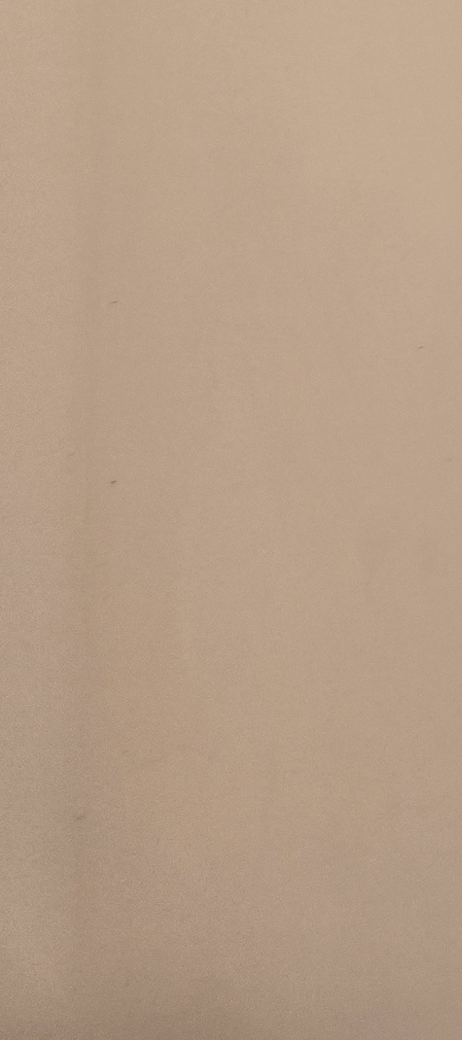 아말감 교체 시기 이렇게 따져보세요 관련 이미지 19