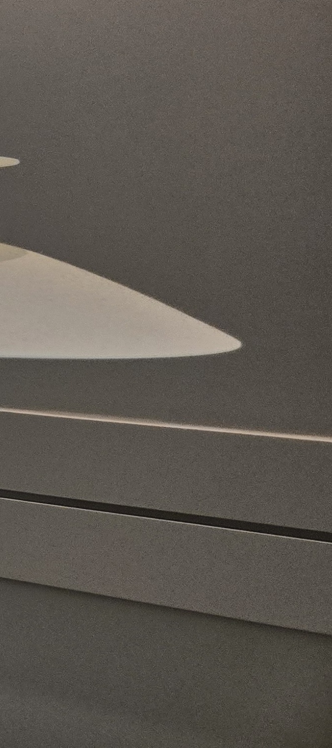 어금니 임플란트 뼈이식 이럴때 해당됩니다 관련 이미지 32