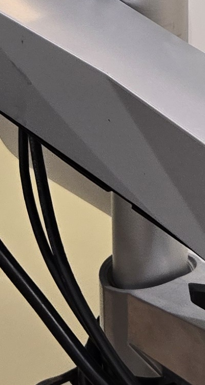 신경치료 아픈가요 망설이시는 분들이라면 관련 이미지 35