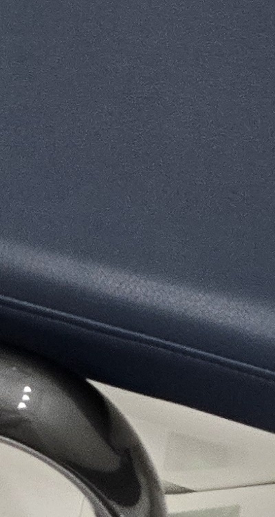 치아 사이 벌어짐 심해지는 이유부터 알아보면 관련 이미지 44