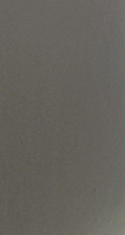 앞니 틀어짐 교정 조화롭게 마무리하려면 관련 이미지 43