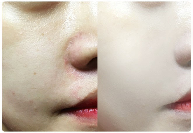 촉촉한쿠션 악건성이라면! 관련 이미지 12