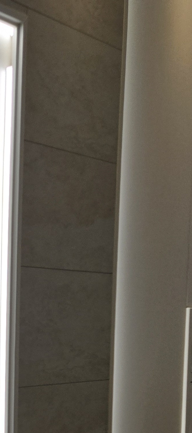 어금니 충치 단계 미리 알아차리려면 관련 이미지 17