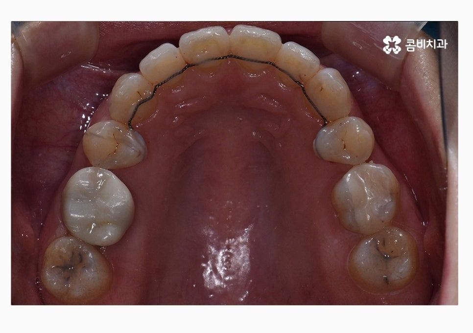 콤비교정 합리적으로 판단하려면 관련 이미지 17
