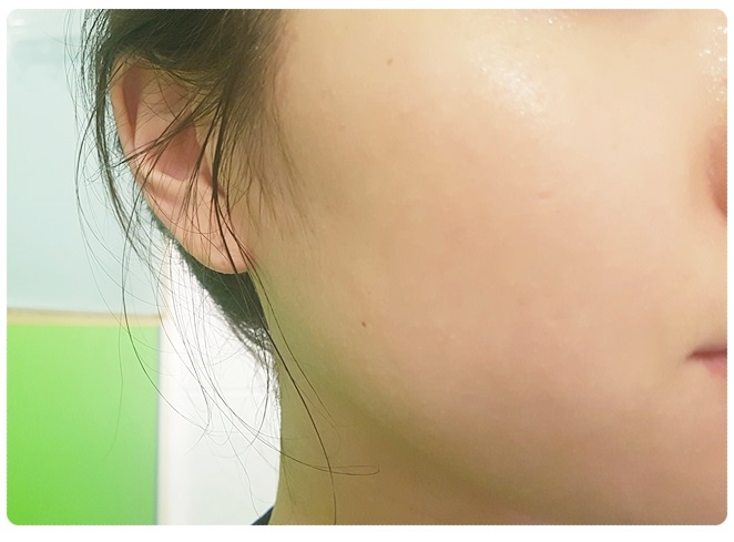 얼굴각질제거제추천 왜이제야왔니 관련 이미지 8