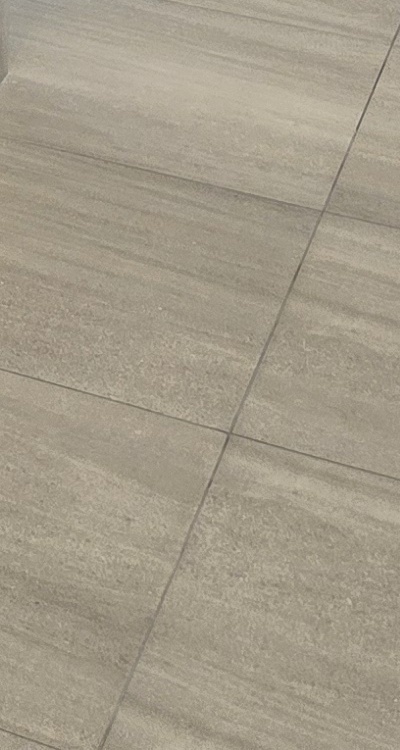 임플란트의 장점 할까 말까 고민이신 분들을 위한 정리 관련 이미지 47