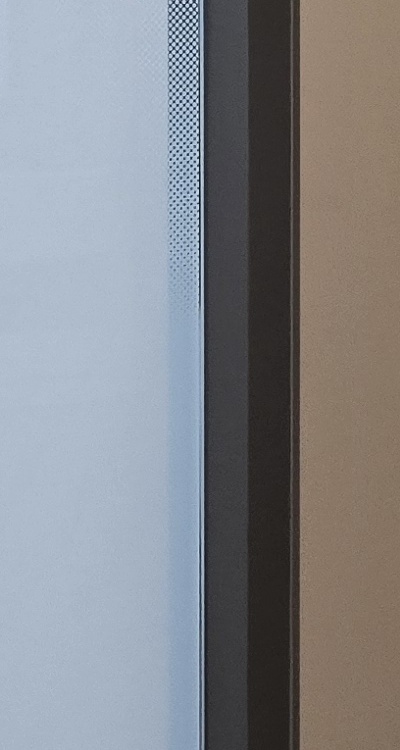 사랑니 발치 후 충치 치료 둘다 준비하려면 관련 이미지 35