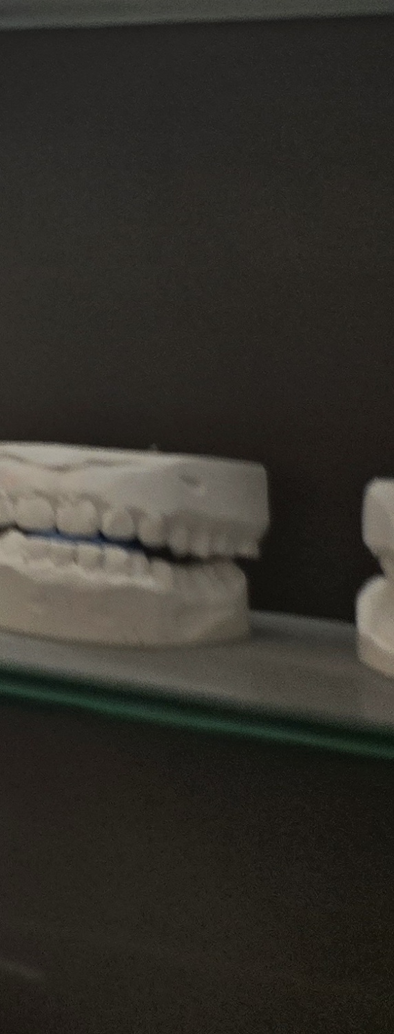 치과 치아미백 효과 어떤식으로 나타날까 관련 이미지 43