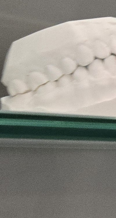 사랑니 주변 잇몸 통증 지금부터가 중요하니까 관련 이미지 25