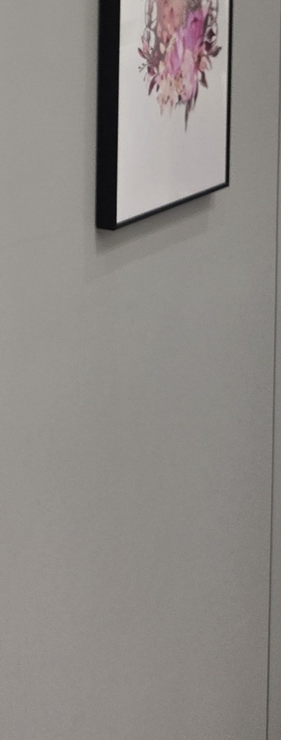 앞니 크라운 교체 깔끔하게 정리하려면 관련 이미지 41