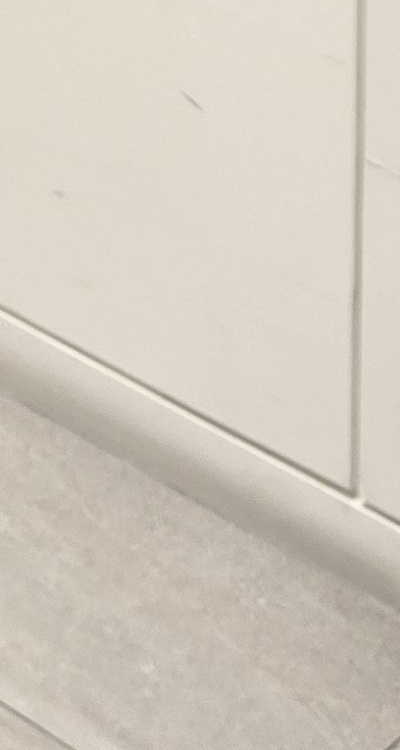 송곳니 크라운 티가 안나게 해결 가능한건가요 관련 이미지 43