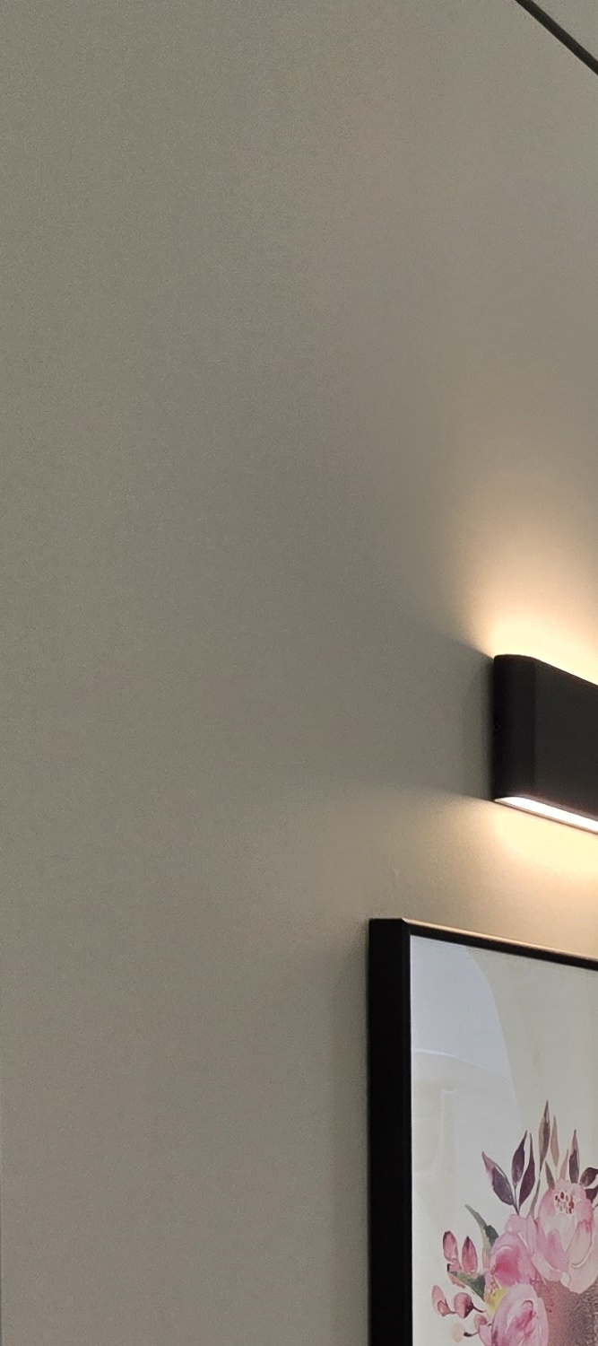 앞니 틀어짐 교정 방법 이럴때는 좀더 간단해요 관련 이미지 22