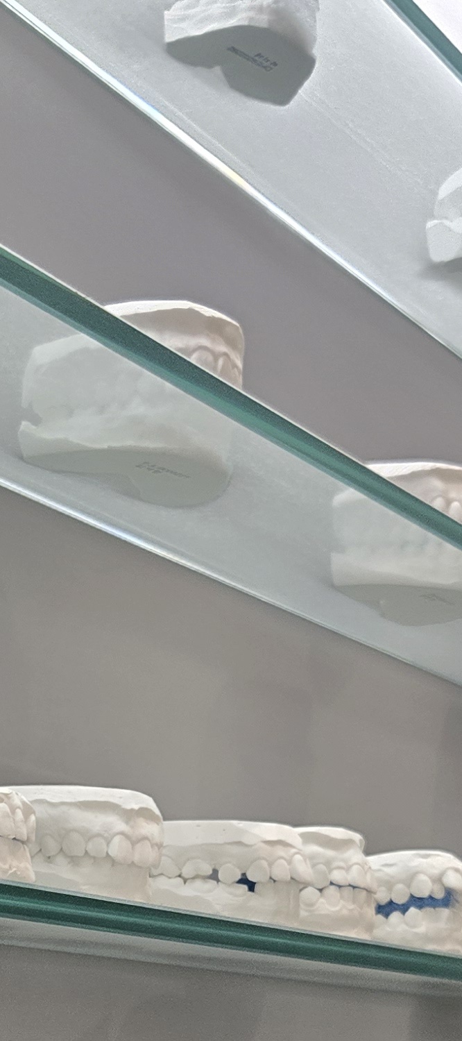 오래된 보철물 아말감 교체 어떠한 케이스일까 관련 이미지 13