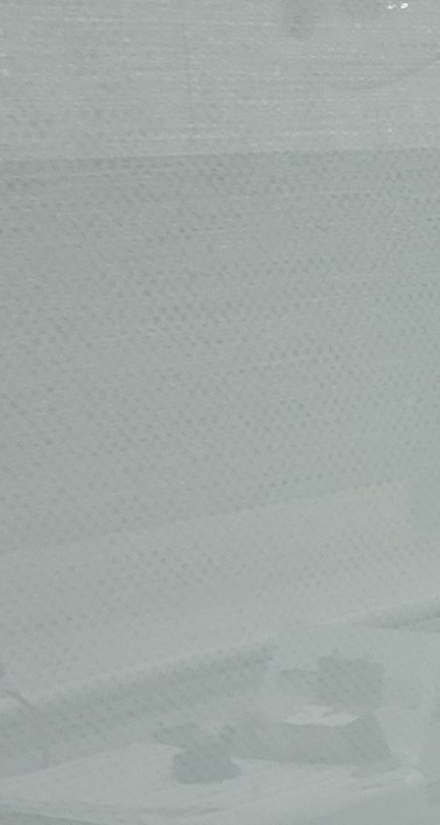 충치 검은점 나타났다면 이렇게 대처해요 관련 이미지 23