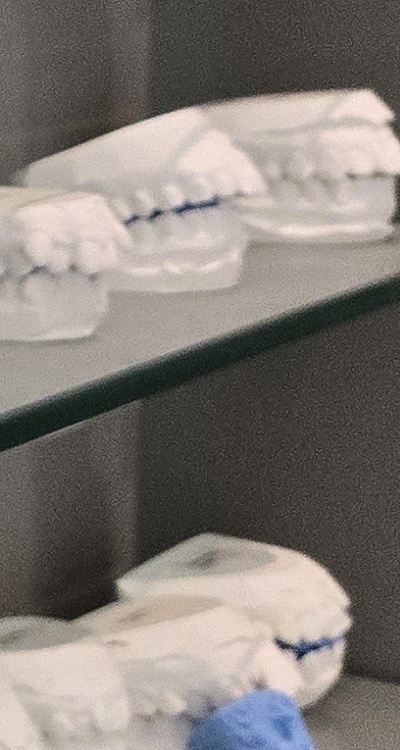 사랑니 주변 잇몸 통증 지금부터가 중요하니까 관련 이미지 40