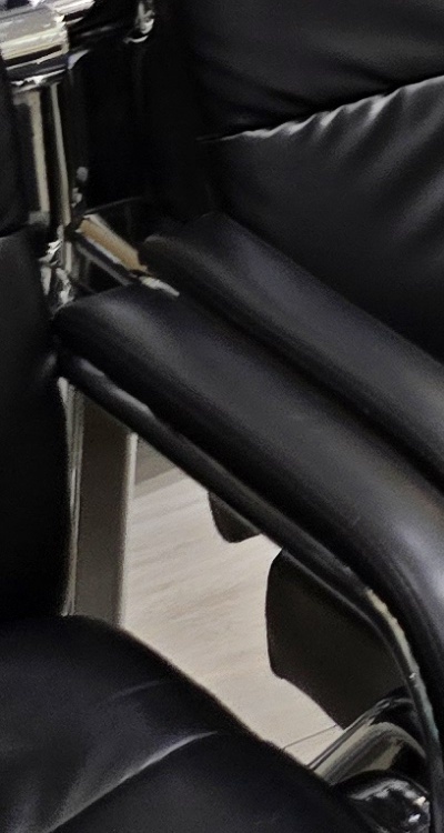 임플란트 뼈이식 안하면 어떤 문제가 있는거죠 관련 이미지 45