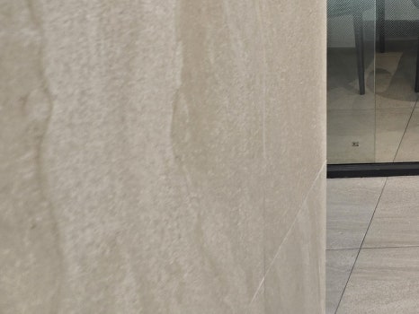 65세이상 임플란트 개수 구체적으로 체크하려면 관련 이미지 16