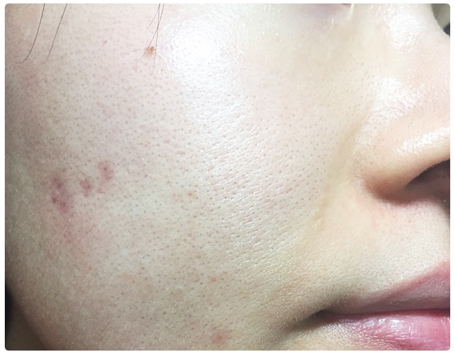 필링패드추천 지성은 다 드루와 관련 이미지 11