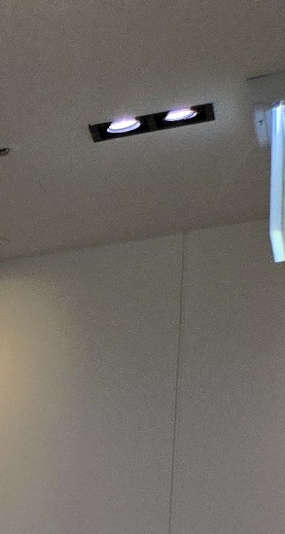 앞니 틀어짐 교정 조화롭게 마무리하려면 관련 이미지 17