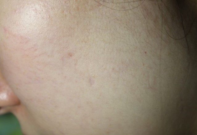 스파클링마스크 모공을 촘촘하게 관리해주는 인클로즈 시크릿 데일리케어 마스크 관련 이미지 13