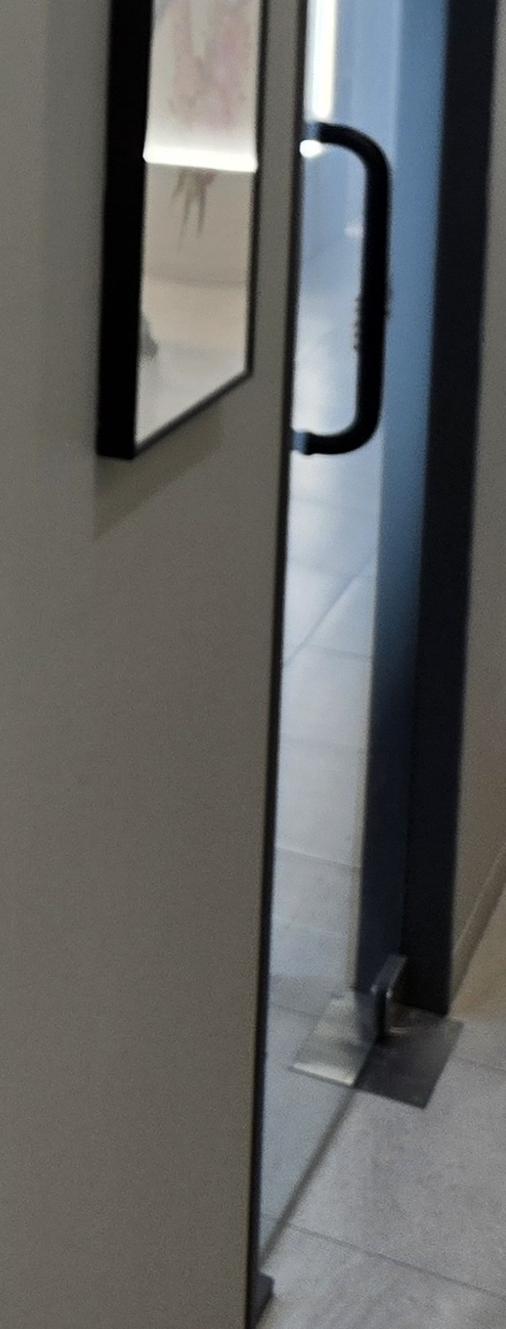 충치 치아 깨짐 시점이 관건이라면 관련 이미지 24