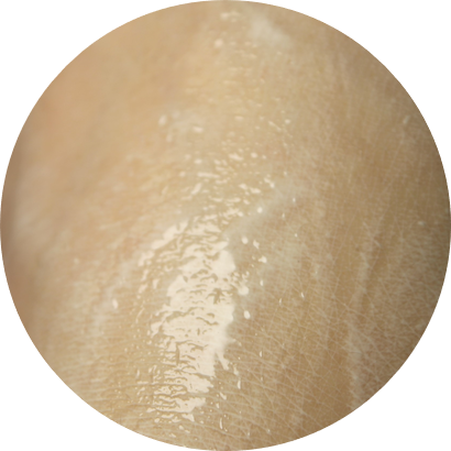 여드름피부 클렌징 살리실산으로 개운하게 마무리 관련 이미지 8