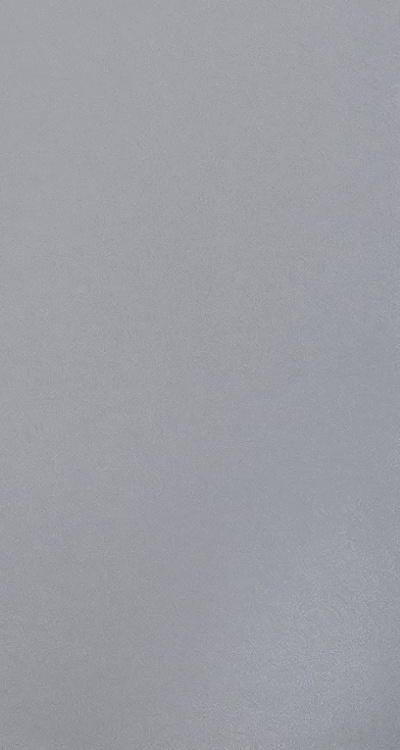 앞니 부분 교정 간단하니까 좋은건가요 관련 이미지 52